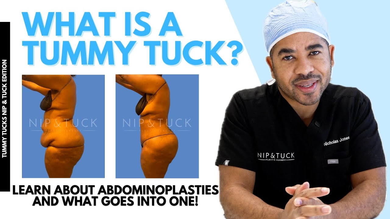Tummy tuck explanation with before-and-after images.