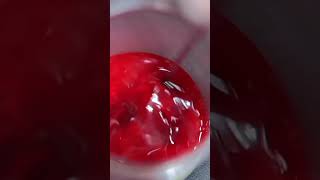 jika racun ular bercampur darah seperti ini||