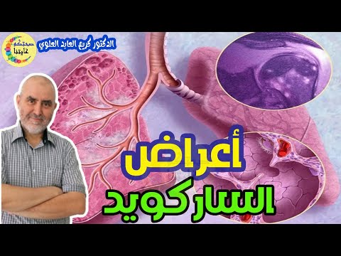 أعراض الساركويد أو مرض الصدفة هل هو مرض مناعي؟   هل له علاج ؟  -  الدكتور كريم العابد العلوي -