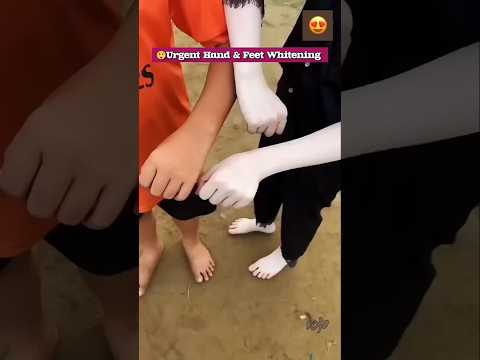 ๐ฑ Fair Hand Tips | Clean Hand Dirt & Tanning | Most Easy Manicure #skincare #beauty #suntan #shorts