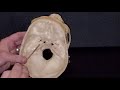 Skull Anatomy and Foramina Identification
