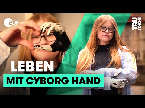 Silvana (26) versteckt ihre Behinderung jahrelang | TRU DOKU