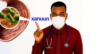 8- cudur ee sababta Bog xanuunka iyo sida loo kala saaro calaamadahooda ( part-1 ) 