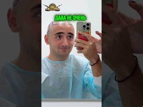 😱 Я СДЕЛАЛ ПЕРЕСАДКУ ВОЛОС!