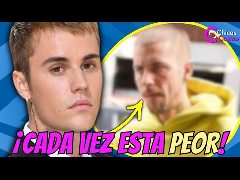 JUSTIN BIEBER EN CRISIS ASEGURAN QUE NECESITO AYUDA URGENTEMENTE#justinbieber #hailey