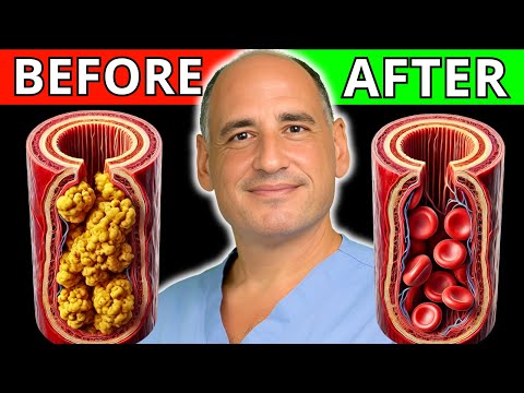 #1 Heart Surgeon: Eat This Meal to Clean Your Arteries