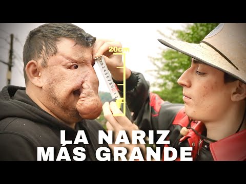24 HORAS TRANSFORMANDO AL HOMBRE CON LA NARIZ MAS GRANDE DEL MUNDO