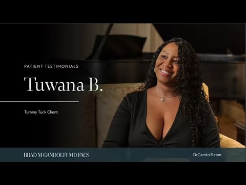 Patient testimonial for tummy tuck client Tuana B.