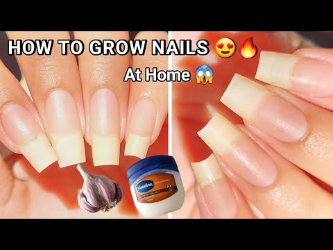 How to grow nails? Nails कैसे Grow करे? #nailgrowth #nailgrow #naturalnails