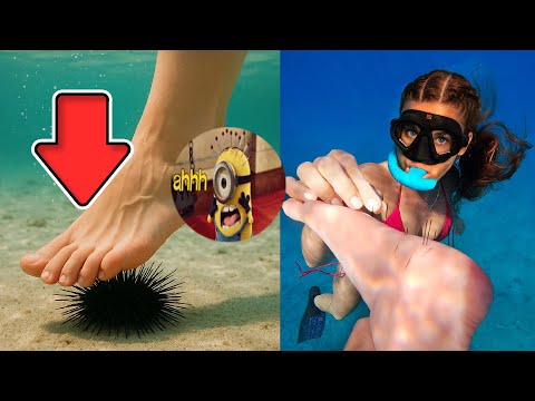 Stomping on sea urchin with ultra realistic fake foot