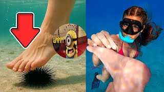 Stomping on sea urchin with ultra realistic fake foot