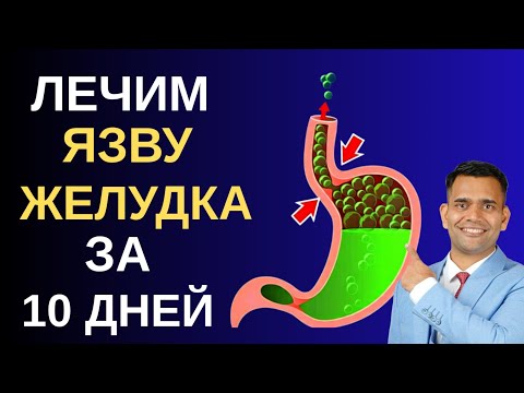 ЯЗВА ЖЕЛУДКА. ЛЕЧИМ ЗА 10 ДНЕЙ!