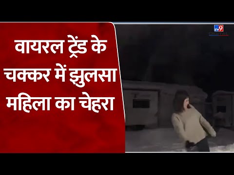 Social Media के वायरल ट्रेंड के चक्कर में झुलसा महिला का चेहरा | Viral Video | Trending Video