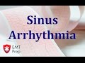Understanding Sinus Arrhythmias