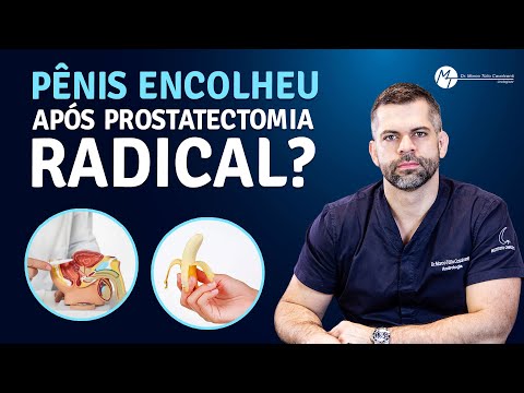 Pênis encolheu após prostatectomia radical? | Dr. Marco Túlio Cavalcanti