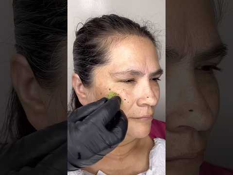 Mi mamá a sus 55 años logró evitar los párpados caídos gracias a esta poderosa mascarilla