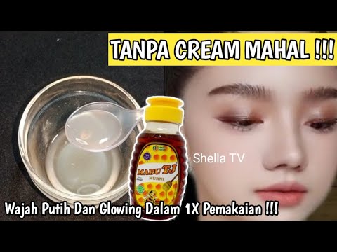 Sampai Di sangka Suntik Putih !!! Wajah Dekil Kucel Penuh Flek Kembali Putih Dan Bersih