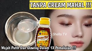 Sampai Di sangka Suntik Putih !!! Wajah Dekil Kucel Penuh Flek Kembali Putih Dan Bersih