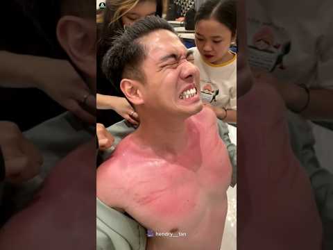 Donโt Peel Sunburned Skin ๐จ #shorts