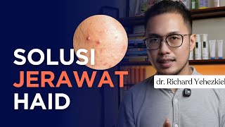 Ini Solusi Jerawat Pas Kamu lagi Haid - Dokter Richard