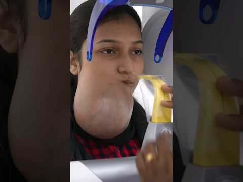 unfortunate girl with very large tumor