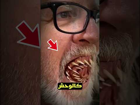 هذا الرجل يبدو كالوحش الحقيقي 😲🏃♂️