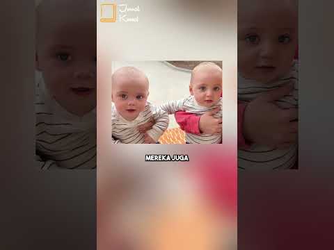 Ketika Sesama Kembar Identik Menikah | The Salyers Twin #faktaunik #shorts