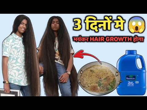 पतले बालों को 3 दिन में घना, मोटा और लंबा बनाने के लिए असरदार नुस्खा | Grow Long Hair Fast Naturally