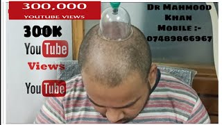 Hair Growth Treatment By Hijama Cupping Therapy Videos Kansas