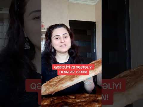 KİMİN XƏSTƏLİYİ VƏ QƏBİZLİYİ VARSA, BAXIN!