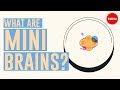 Understanding Brain Organoids