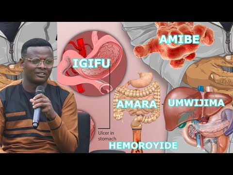 IVURE AMIBE, IGIFU, UMWIJIMA, AMARA, HEMOROYIDE NA HELENI UFASHIJWE NA MUGANGA MICOMYIZA #0788990576