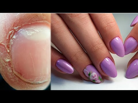 Huge Transformation On Stubby Nails / Snipping Off Cuticle With A Nail Drill 💅