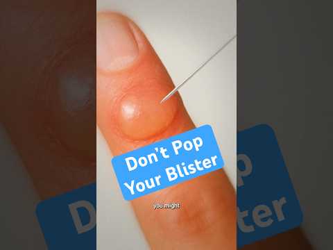 Don't Pop Your Blister