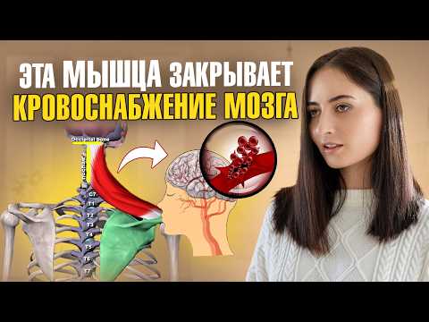 Плохое кровоснабжение мозга, боль в шее, инсульт, повышение давления — всё из-за ЭТОЙ мышцы