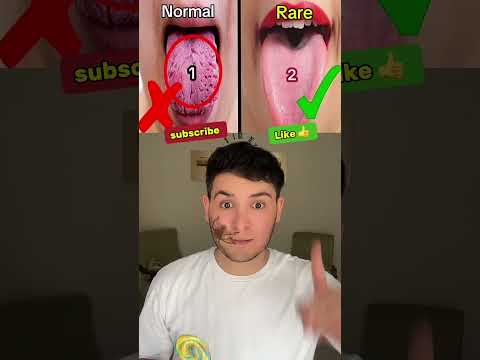 Which one is yours, 1 or 2?