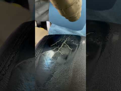 Center console vinyl repair