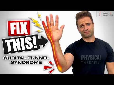 Fix Cubital Tunnel Syndrome! [Exercises For Ulnar Nerve Entrapment]