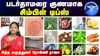 படர்தாமரை அரிப்பு நீங்க | Padarthamarai sari seivathu eppadi | Fungal Infection | Doctor Interview