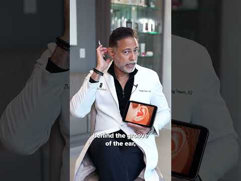 Dr. Grover Explains the SurgYlift