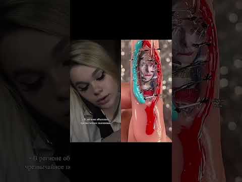 Эпидемия. 1 часть #тренды #rek #fup #scary #fypシ゚viral #popular