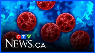 YouTube video thumbnail: Quebec Has 223 Cyclosporiasis Cases so Far in 2026