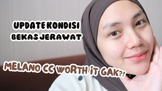 MELANO CC UNTUK BEKAS JERAWAT? | raniekarlina