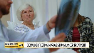 Biomarker Testing Improves Lung Cancer Treatment