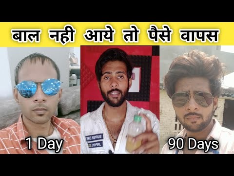 Best hair oil for hair growth Pt. 3 / हेयर ग्रोथ ऑयल कैसे उसे करना है और क्या-क्या डाइट फॉलो करना है