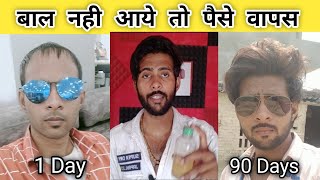 Best hair oil for hair growth Pt. 3 / हेयर ग्रोथ ऑयल कैसे उसे करना है और क्या-क्या डाइट फॉलो करना है