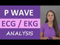 Understanding P Waves in ECG