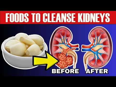 10 Foods That Will CLEANSE Your Kidneys FAST!