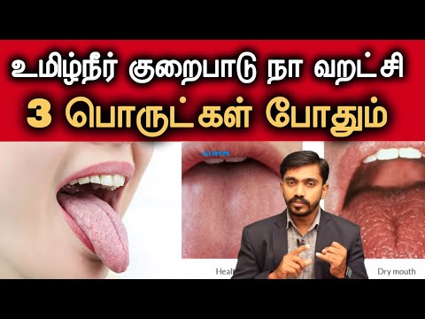 வாய் வறட்சி DRY MOUTH, வாய் துர்நாற்றம்?? அருமையான தீர்வு!! | DrSJ