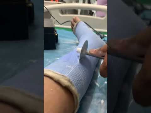 Trampoline Park Accident๐จ๐ซฃ #shorts #mumbai #india